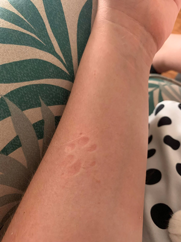 cat paw print on arm